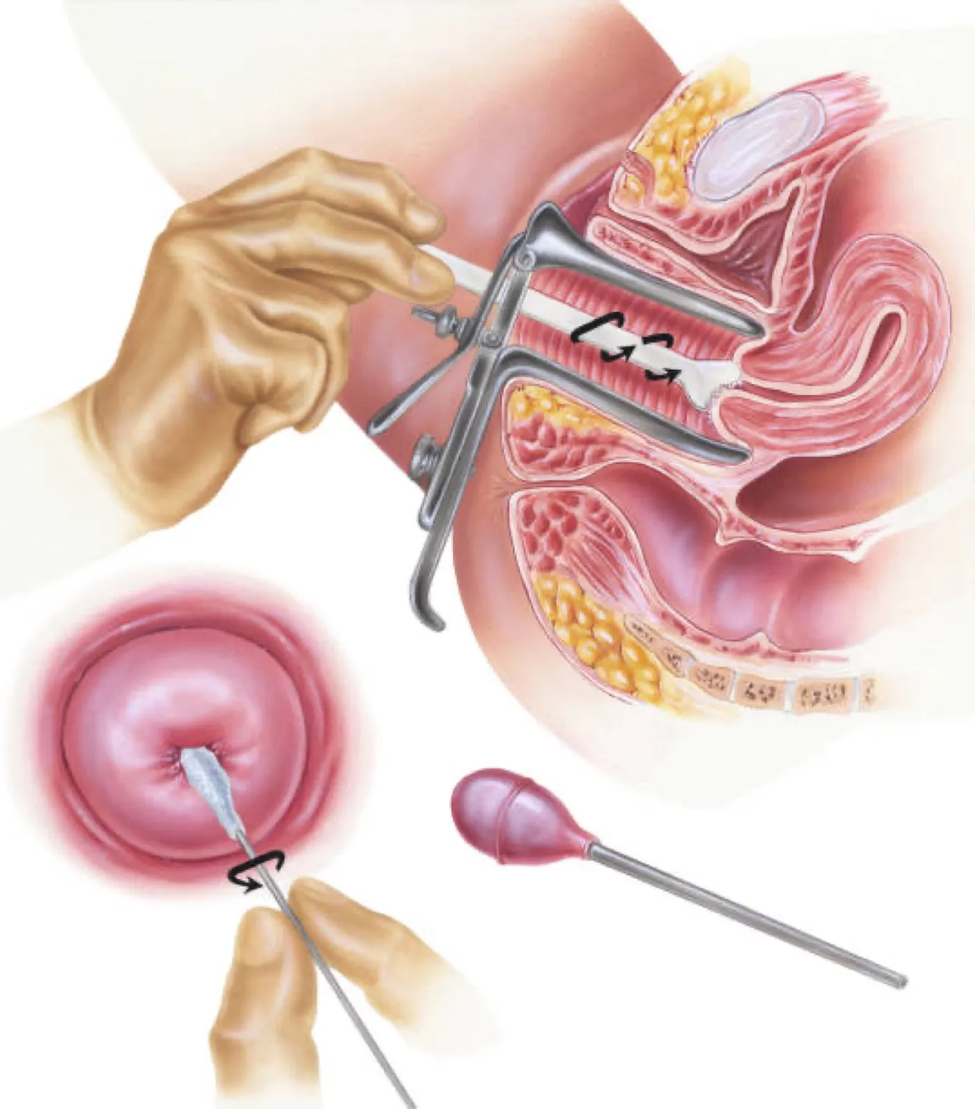 Pap Smear in Nigeria, Cervical Cancer Screening, Women's Preventive Care